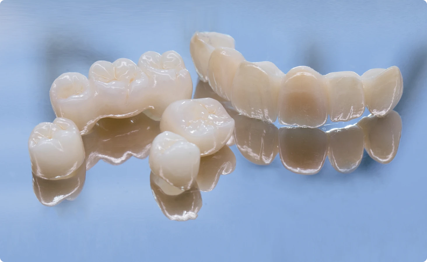 Couronnes dentaire dentiste Bajanescu 39110