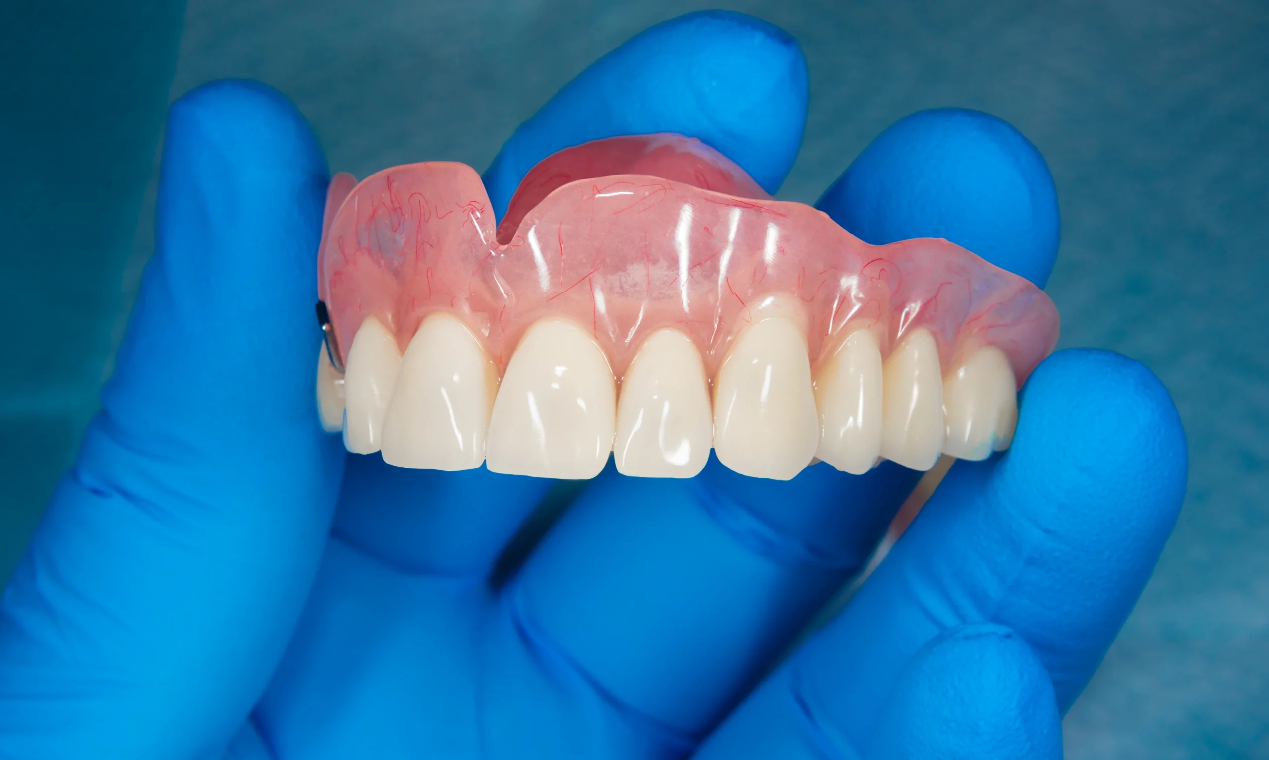 Les prothèses remplacent toutes les dents sur une ou deux arcades au cabinet dentaires Bajanescu