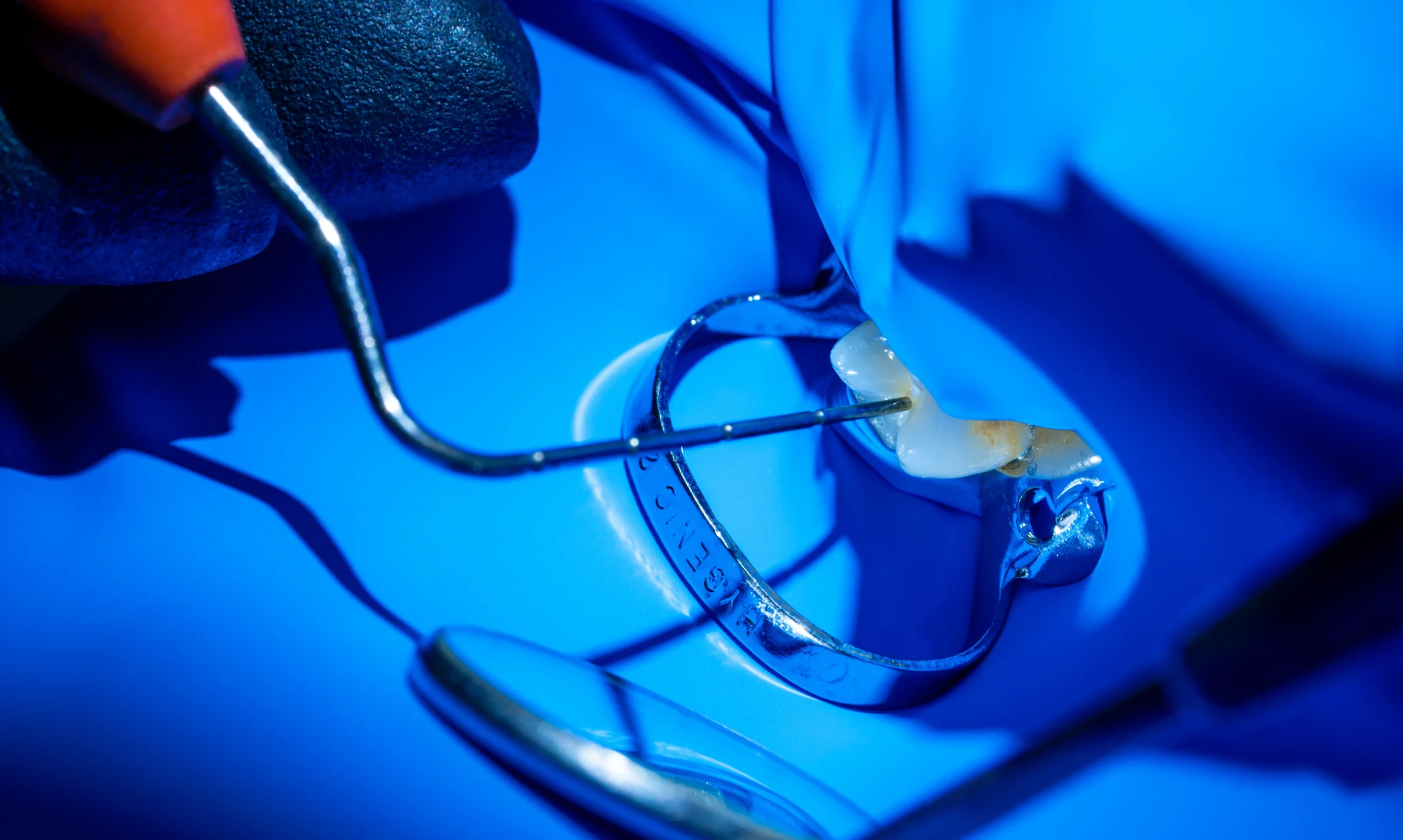 restauration dentaire céramique haute qualité Salins les Bains Bajanescu 39110