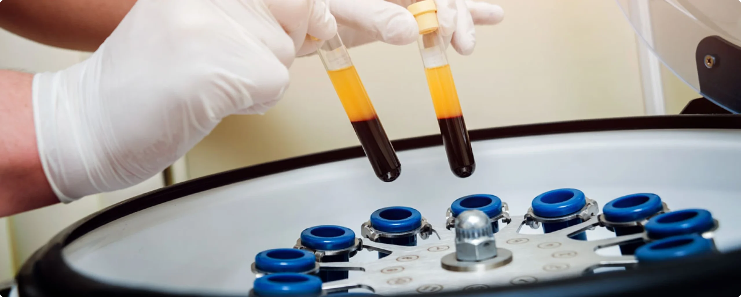 Nos technologies : radio 3D CONE BEAM, microscope opératoire, caméra d'empreinte optique au cabinet du Dr Bajanescu